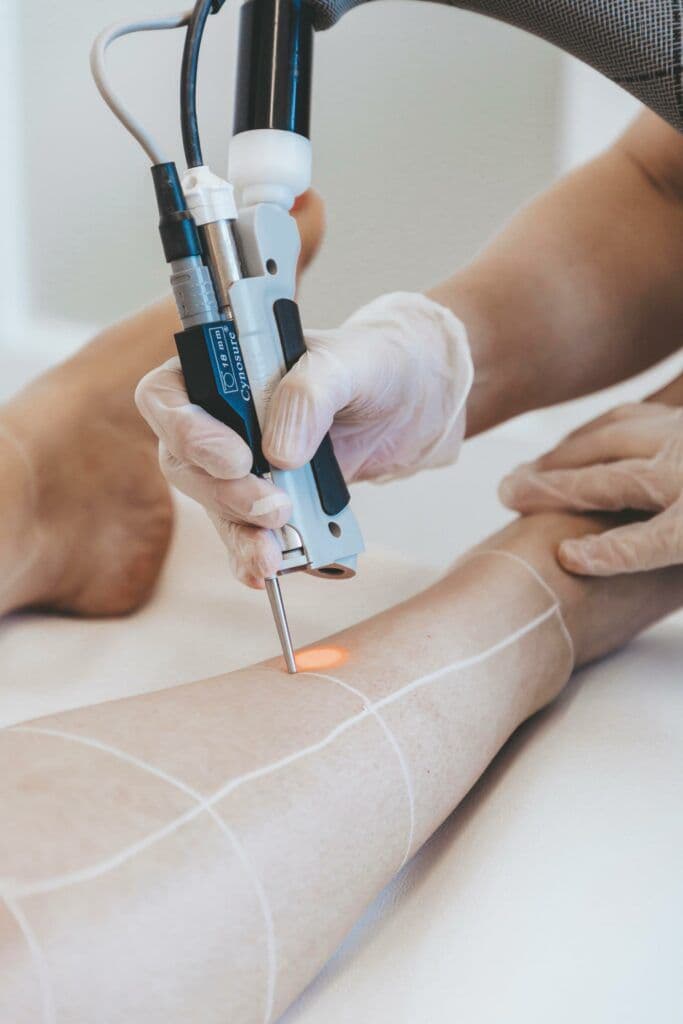 Laser hair removal session on the medspa floor